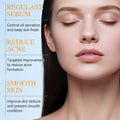 KORMESIC痘痘干燥乳液facial lotionw保湿外贸跨境厂家批发直销