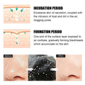 EELHOE Bamboo Charcoal Nose Strips - Blackhead Remover for Clearer Pores