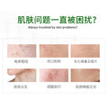 Salicylic Acid Acne Repair Cream - Centella Soothing Care for Sensitive Skin