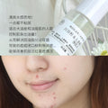 Ginseng Root Purifying Toner - Balances Oil & Soothes Acne-Prone Skin