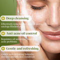 KORMESIC全英文绿茶净痘洁面乳Facial Cleanser跨境外贸厂家批发